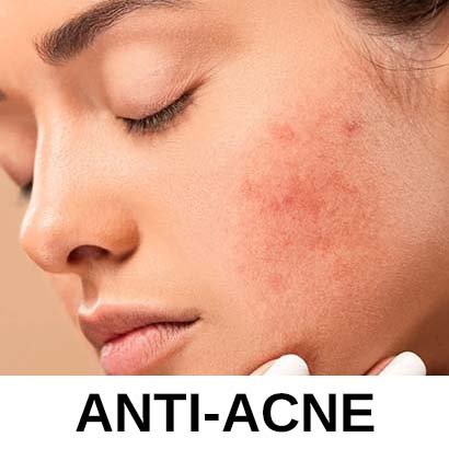 Anti - Acne