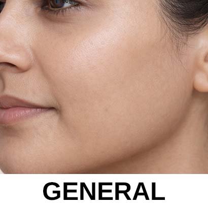 General